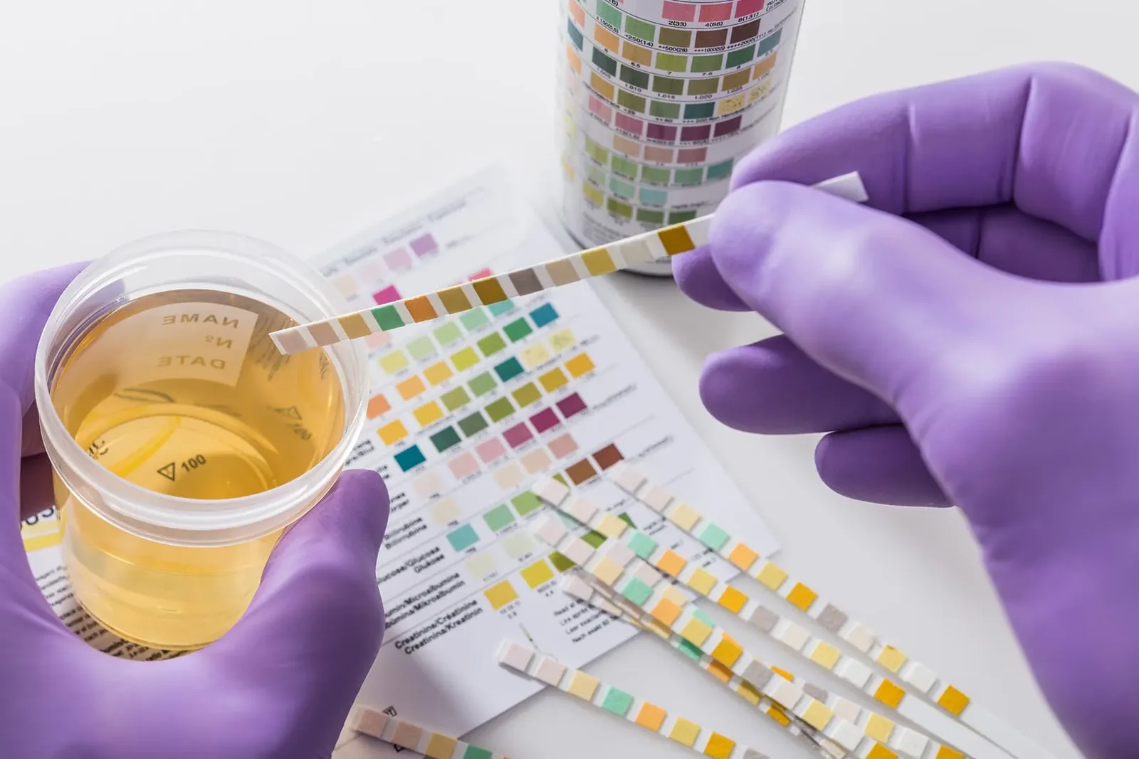 Does CBD Show Up on a Drug Test? What Actually Changes the Risk